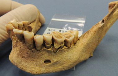 Neolithic caveman teeth