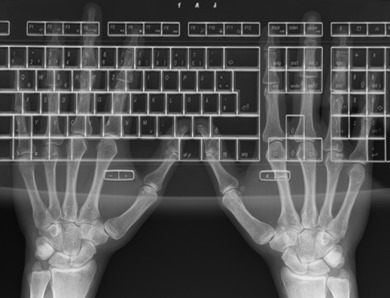 Ontology and Keyboard