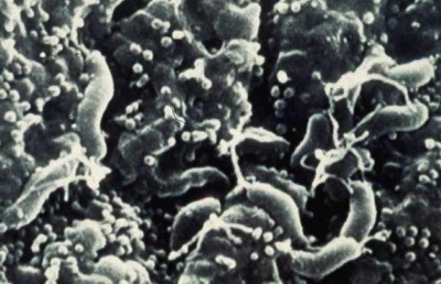 Helicobacter pylori