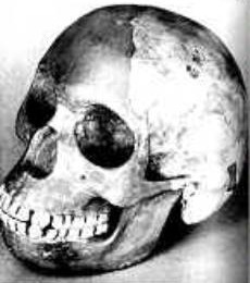 Piltdown Man