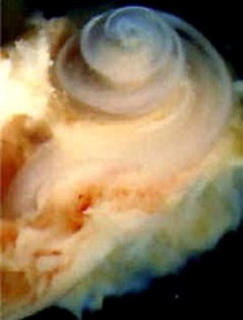 Cochlea / sraigė (vidinė ausis)